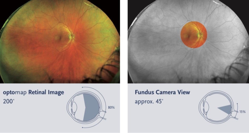 Optomap comparison